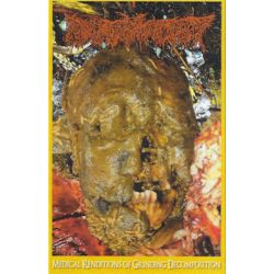 Pharmacist "Medical Renditions Of Grinding Decomposition" (Tape)