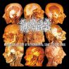 Pathologist "Morbidious History Of Necromantical Sonic Terrorization" (CD)
