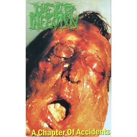 Dead Infection "A Chapter Of Accidents" (Tape)