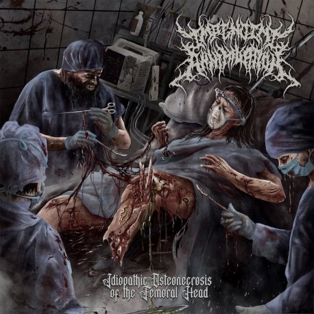 Impending Annihilation "Idiopathic Osteonecrosis Of The Femoral Head" (3" MCD)