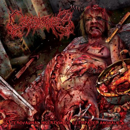 Cephalotripsy "Uterovaginal Insertion Of Extirpated Anomalies" (SlipcaseCD)