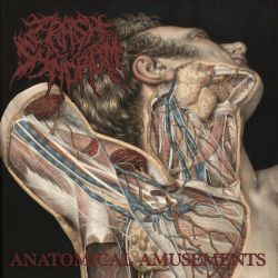 Crash Syndrom "Anatomical Amusements" (MCD)