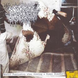 Anorectal Ulceration "Morbid Fascination When Viewing A Human Disaster" (LP)