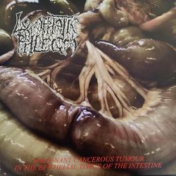 Lymphatic Phlegm/Flesh Grinder "Split" (LP)