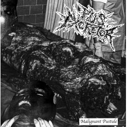 Pus Excretor "Malignant Pustule" (Tape)