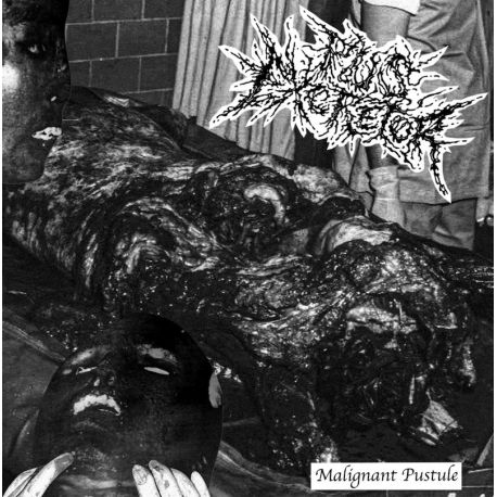 Pus Excretor "Malignant Pustule" (Tape)