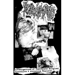 Fulminate "Investigations Of Inadequate Surgical Procedures & Atrocious Exploits" (Tape)