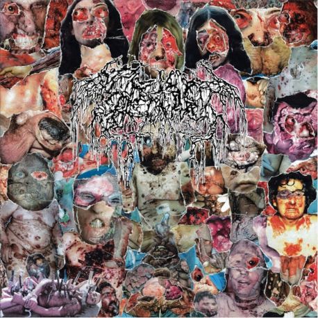Septage "Septic Decadence + Septisk Eradikasyon + Split W. Hyperdontia" (CD)