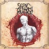 Septic Autopsy "Cadaveric Malignancy" (CD)