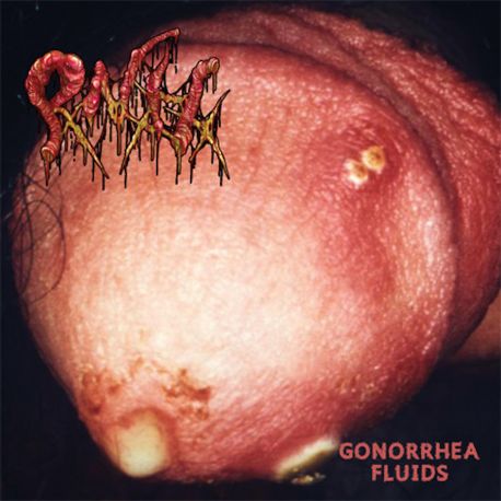 Pankreatite Necro Hemorrágica/Necrocannibalistic Vomitorium "Gonorrhea Fluids/Suspension" (CD)